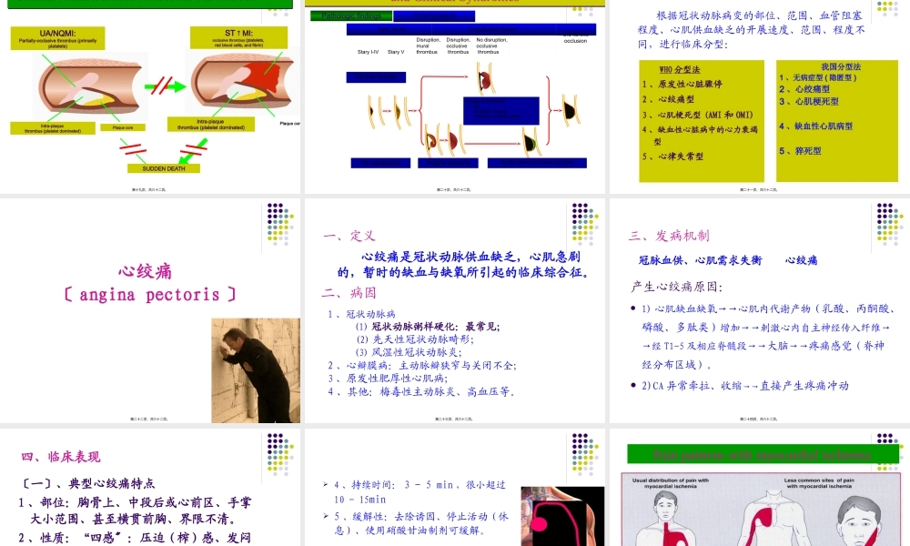 冠状动脉粥样硬化性.pptx