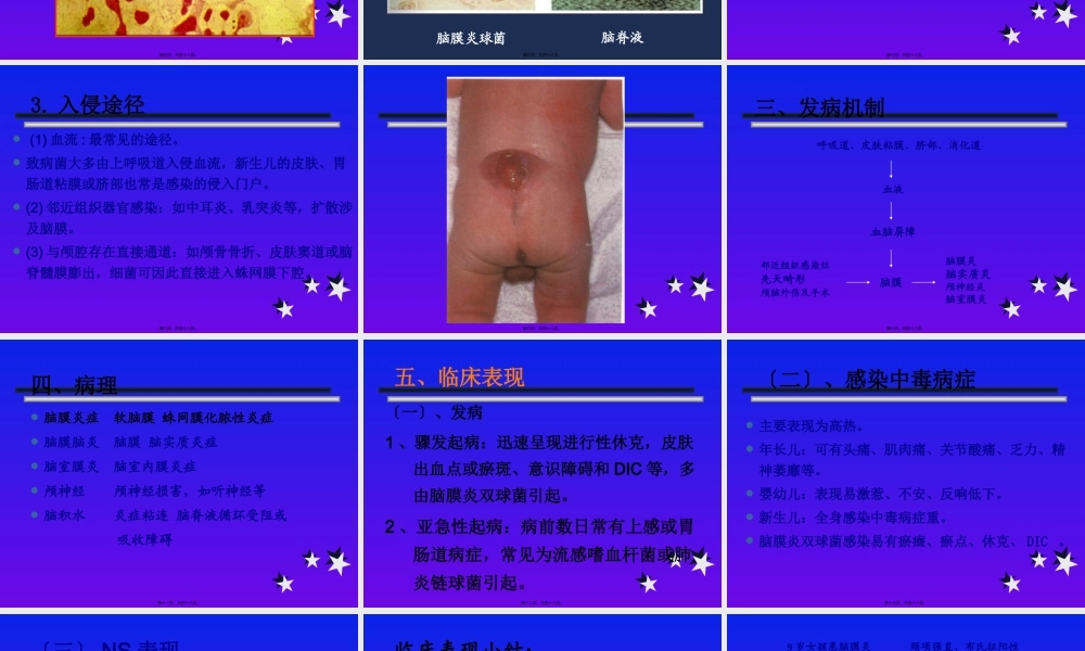 化脓性脑膜炎修改-PPT文档资料.pptx