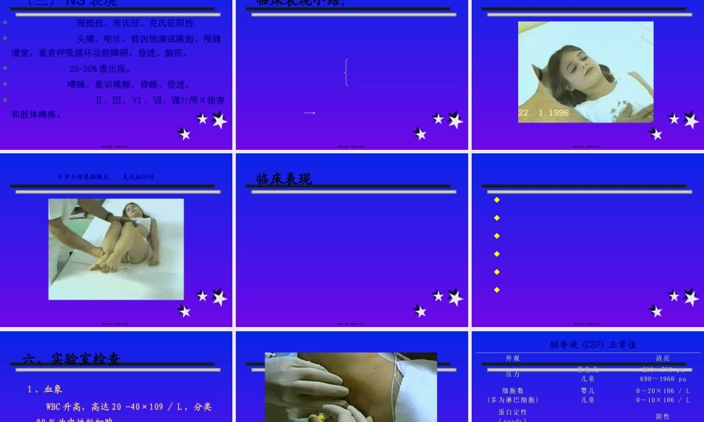 化脓性脑膜炎修改-PPT文档资料.pptx