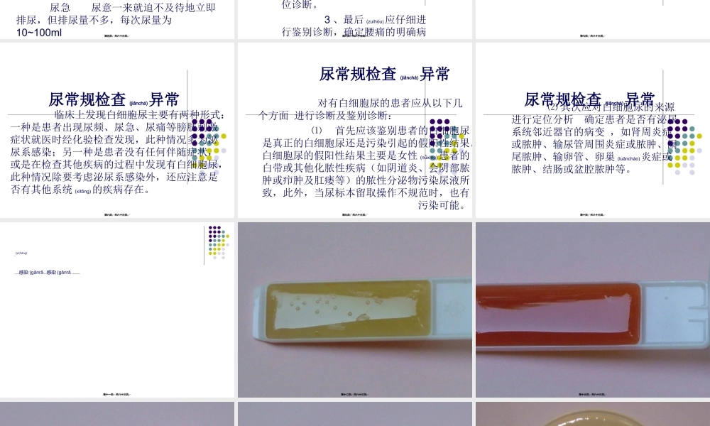 2022年医学专题—尿路感染的诊治与健康宣教.ppt