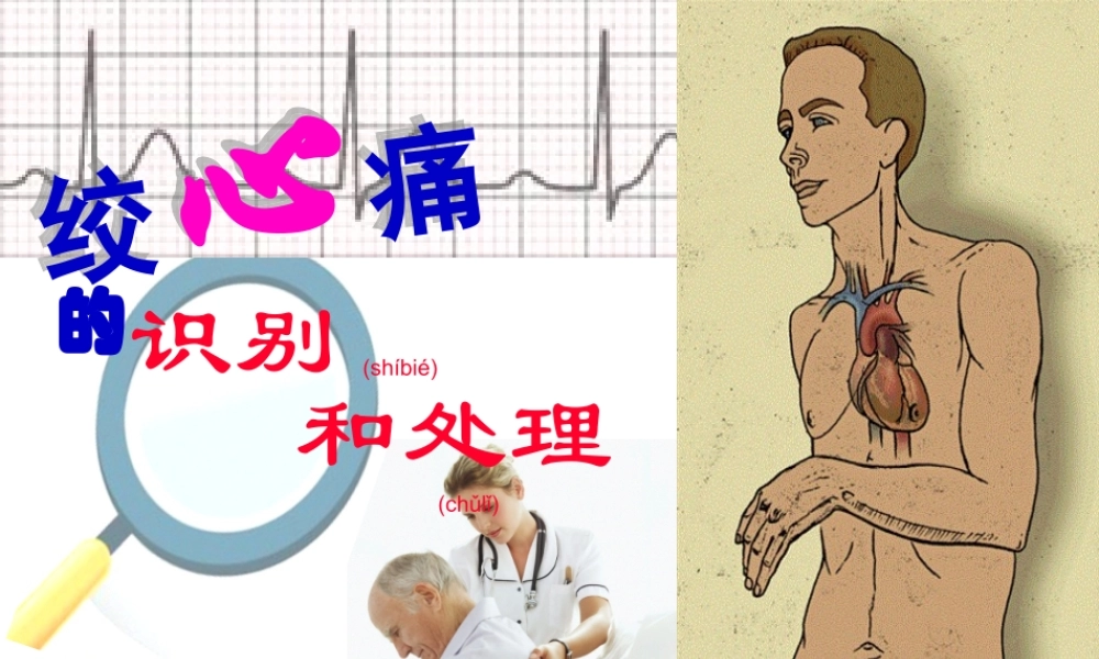 2022年医学专题—心绞痛识别和处置.ppt