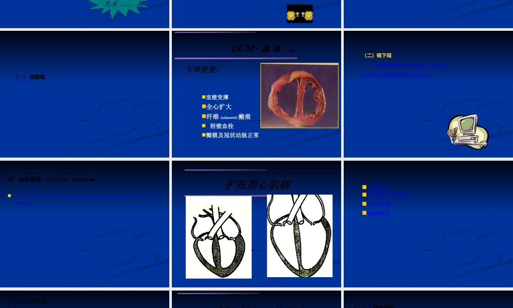 2022年医学专题—扩张型心肌病幻灯.ppt