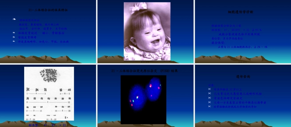 儿科第八章--染色体病和遗传性代谢病.pptx