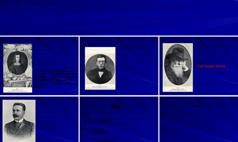 2022年医学专题—伤寒与副伤寒辛小娟(1).ppt