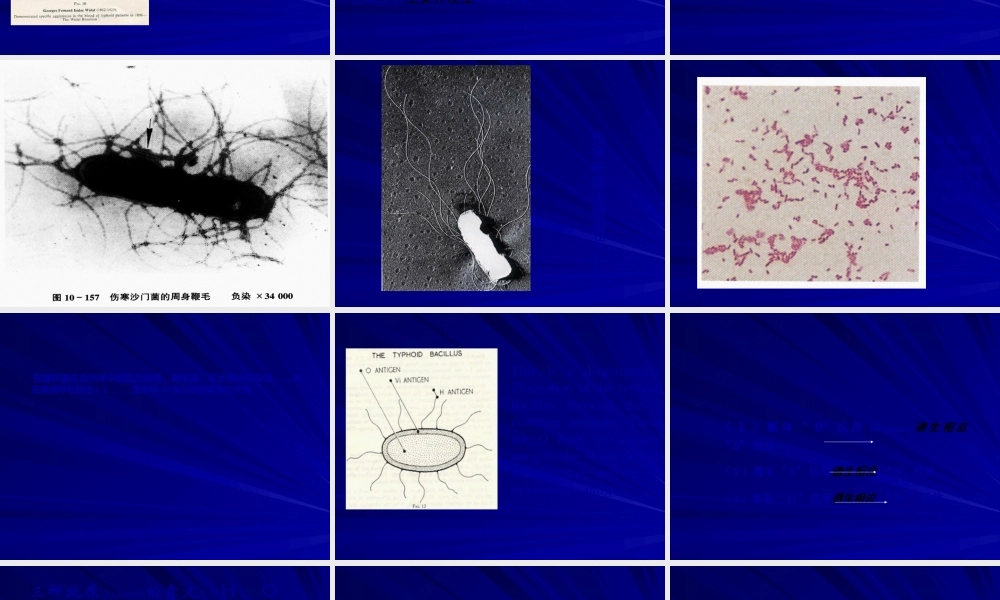 2022年医学专题—伤寒与副伤寒辛小娟(1).ppt