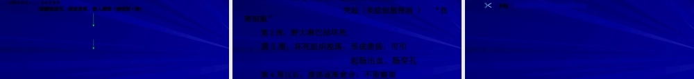 2022年医学专题—伤寒与副伤寒辛小娟(1).ppt
