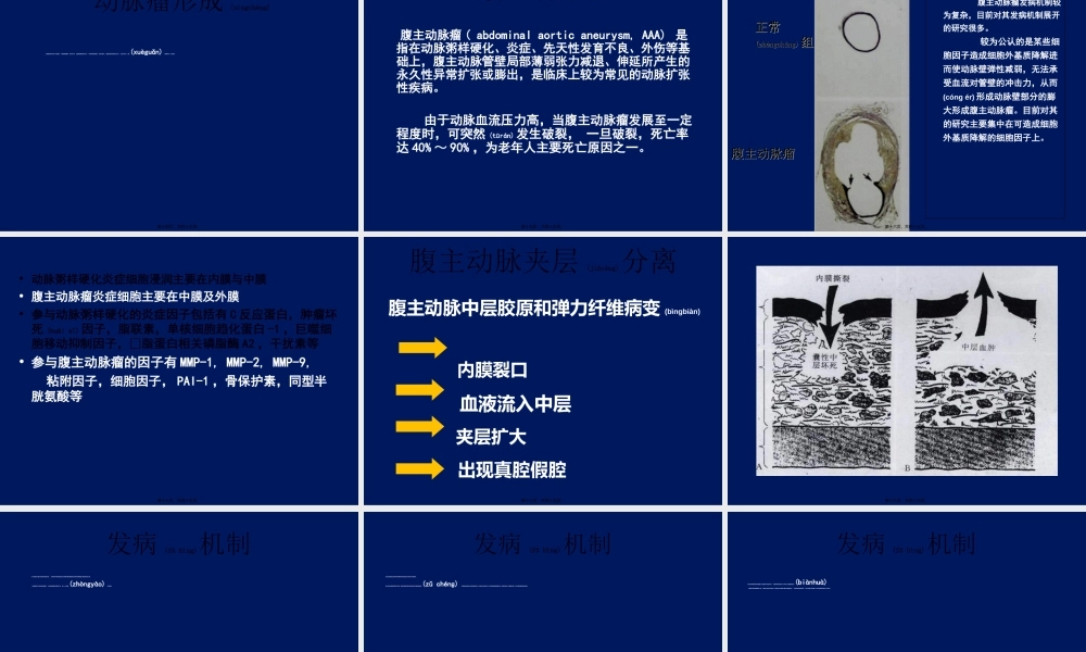 2022年医学专题—动脉粥样硬化与腹主动脉瘤(1).ppt