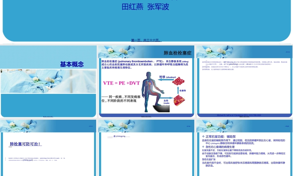 2022年医学专题—大面积肺栓塞与急性右心功能不全.ppt