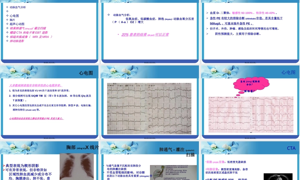 2022年医学专题—大面积肺栓塞与急性右心功能不全.ppt