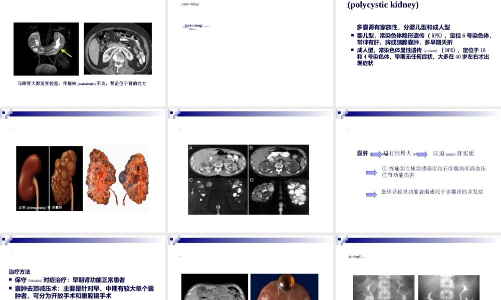 2022年医学专题—第59章-泌尿生殖系统畸形(叶章群).ppt