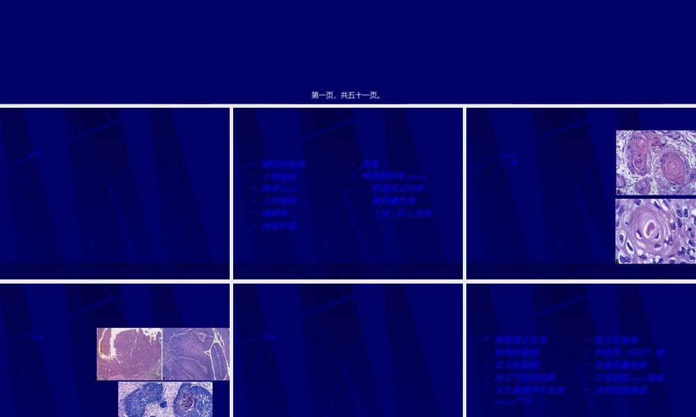 2022年医学专题—肺癌分类简介.ppt