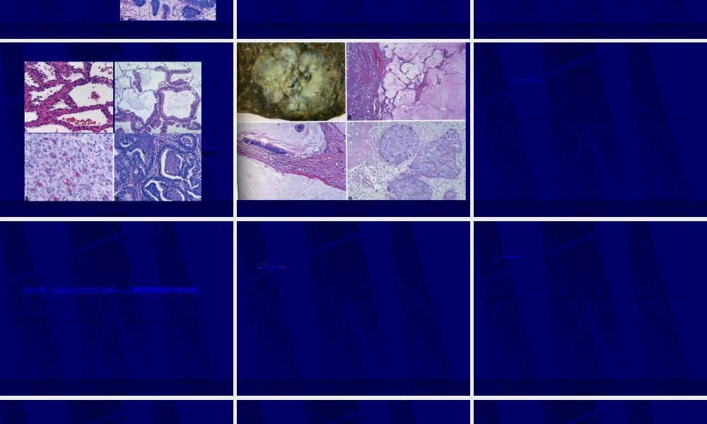 2022年医学专题—肺癌分类简介.ppt