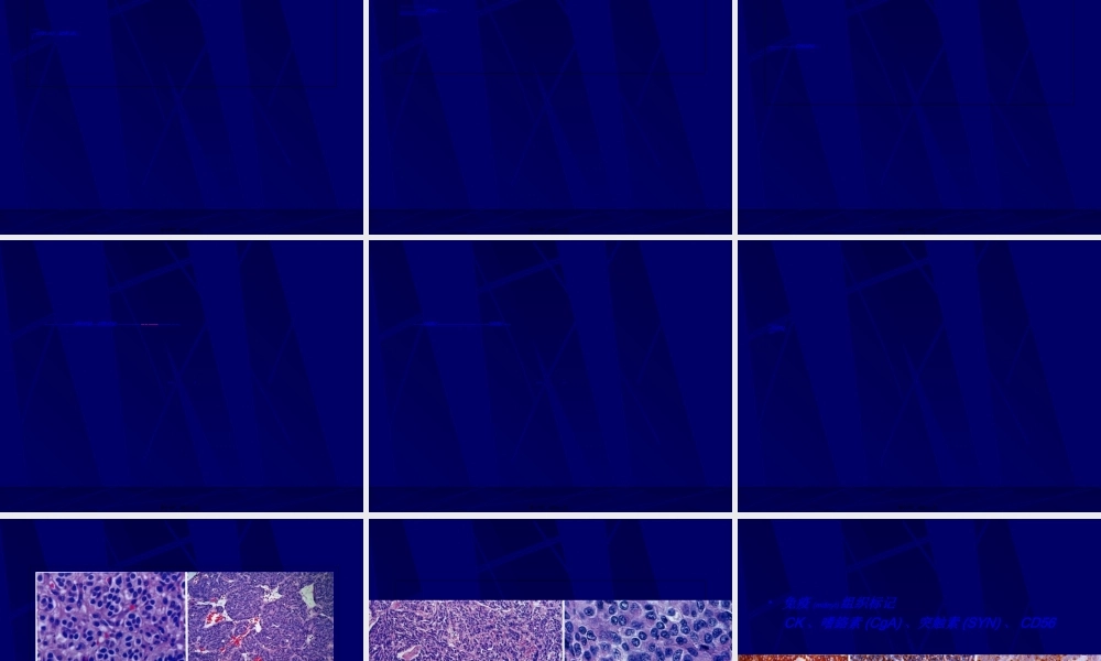 2022年医学专题—肺癌分类简介.ppt