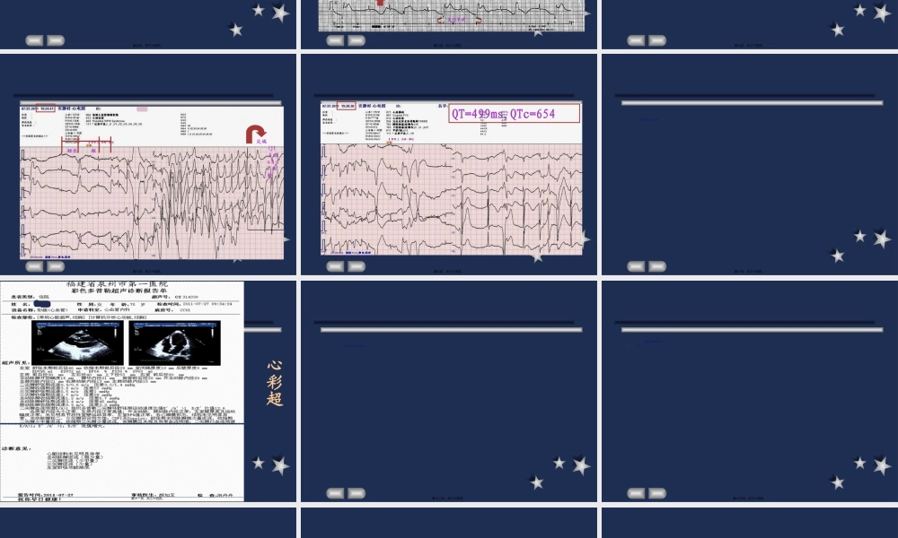 2022年医学专题—晕厥病例一例(1)(1).ppt