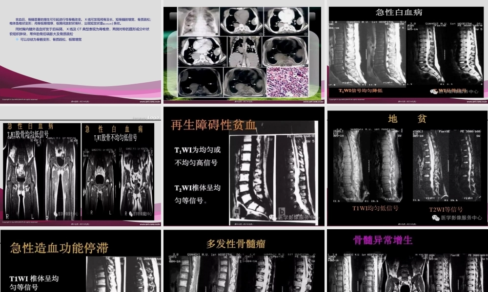 2022年医学专题—浅谈白血病骨质改变(1).ppt