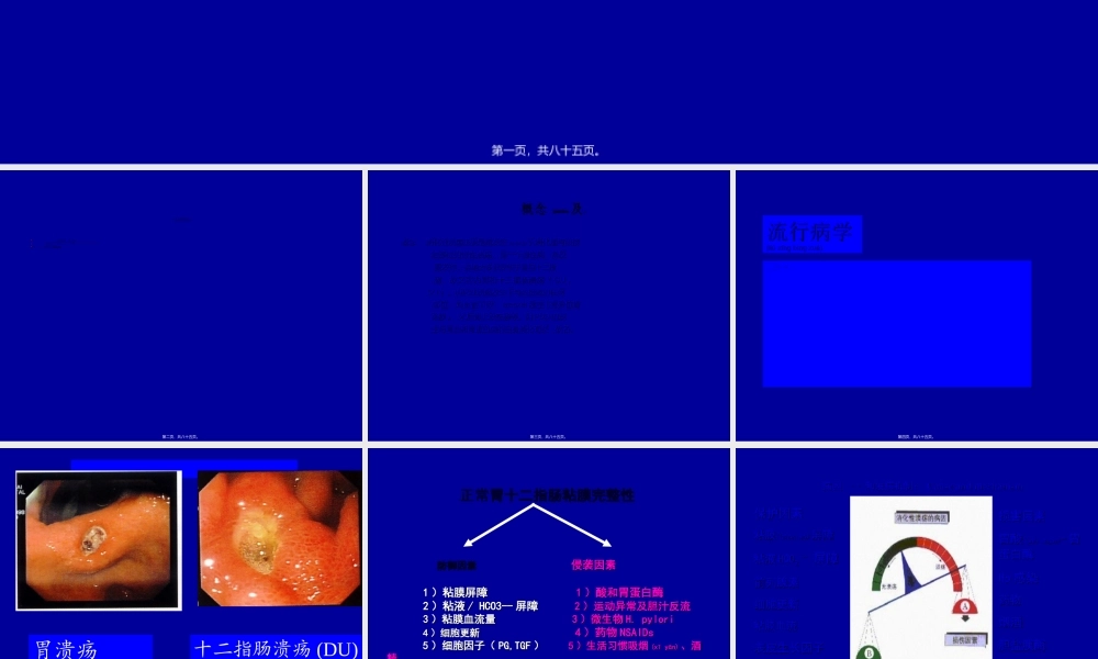 2022年医学专题—消化性溃疡ppt(1).ppt