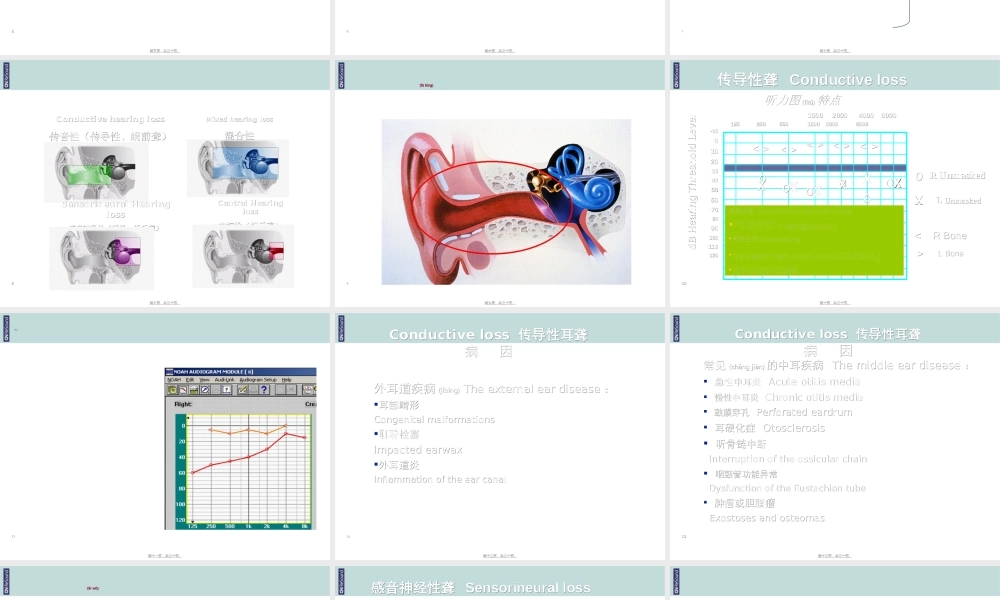 2022年医学专题—耳聋的分类及区别(1).ppt