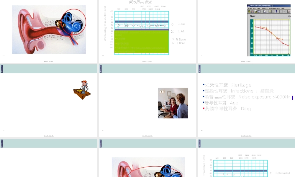 2022年医学专题—耳聋的分类及区别(1).ppt