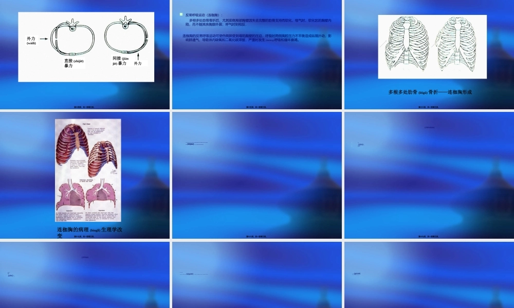 2022年医学专题—胸外伤诊治及新进展(1).ppt