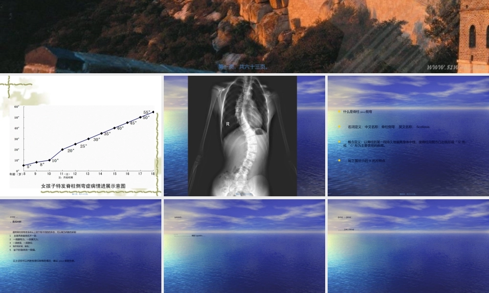 2022年医学专题—脊柱侧凸症的手法矫正(1).ppt
