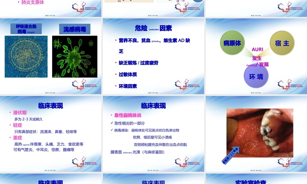 2022年医学专题—儿童上呼吸道感染及合理用药(1).pptx