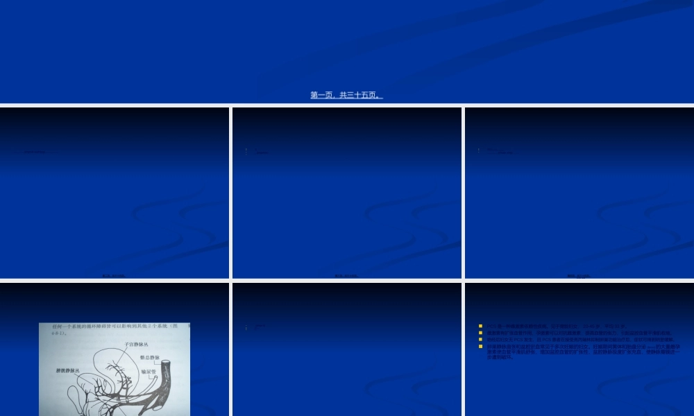 2022年医学专题—盆腔淤血综合征.ppt