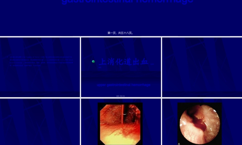 2022年医学专题—其上的消化道出血称上消化道出血其下的消化道出血称为下消化道出血(1).ppt