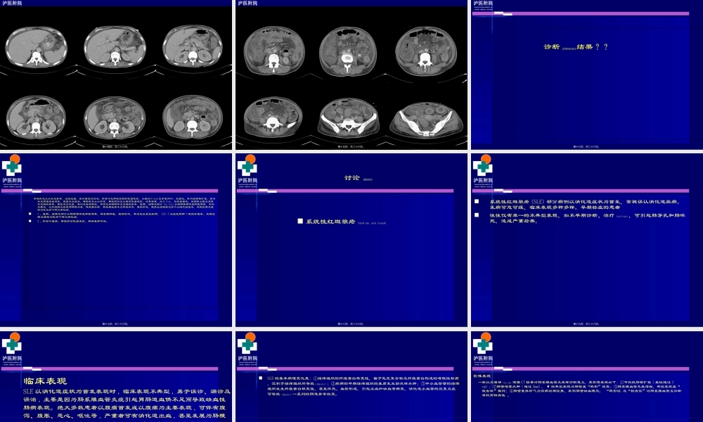 2022年医学专题—系统性红斑狼疮-病例.ppt