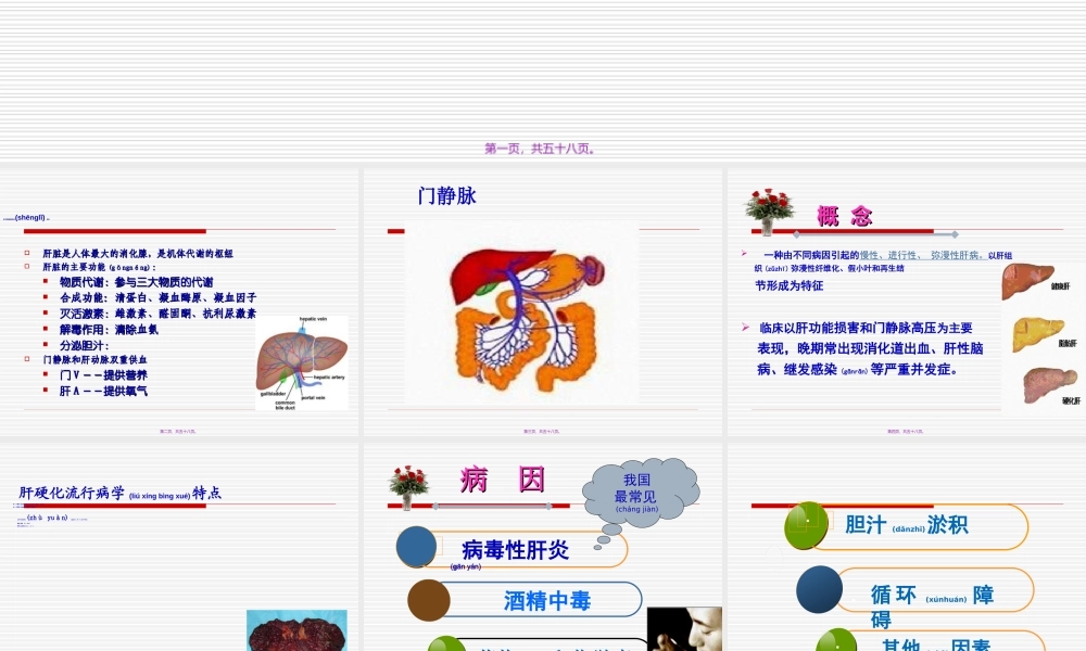 2022年医学专题—肝硬化Microsoft-PowerPoint-演示文稿(1).ppt