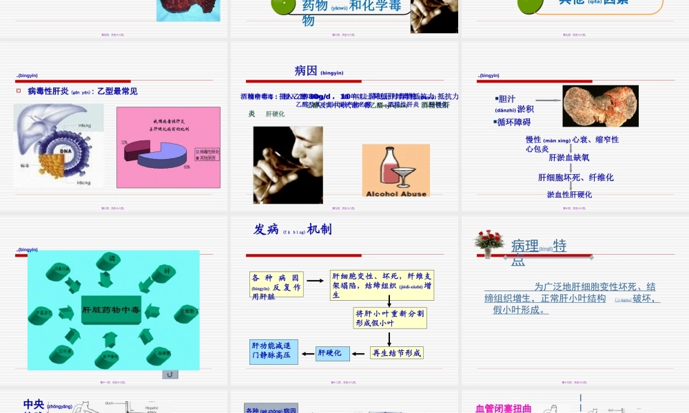 2022年医学专题—肝硬化Microsoft-PowerPoint-演示文稿(1).ppt