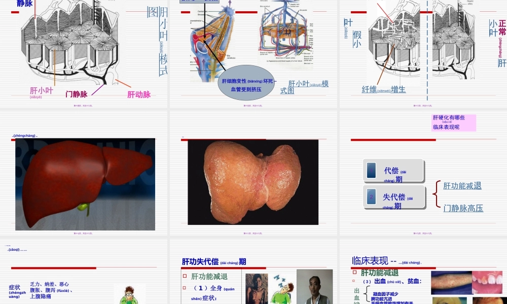 2022年医学专题—肝硬化Microsoft-PowerPoint-演示文稿(1).ppt