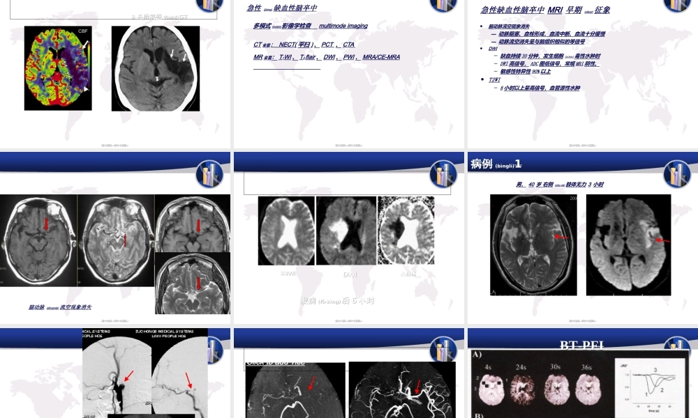 2022年医学专题—缺血性脑血管病CT、MRI新进展.ppt