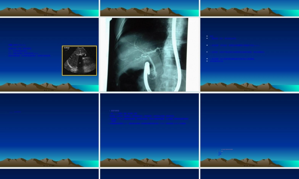 2022年医学专题—胆道感染结石.ppt
