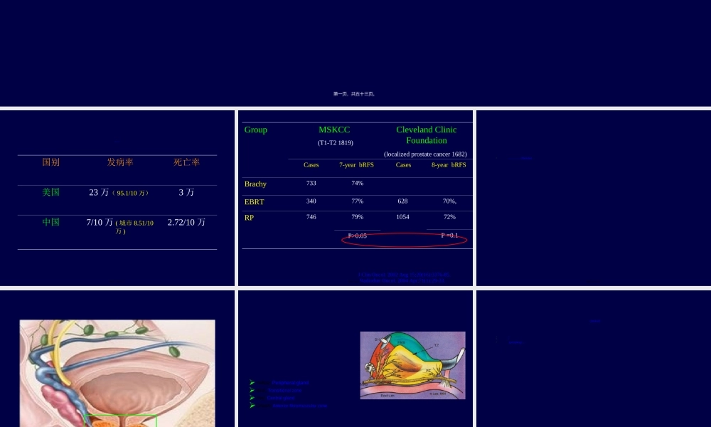 2022年医学专题—前列腺癌靶区勾画(1).ppt