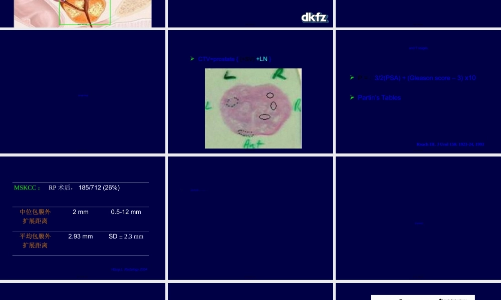 2022年医学专题—前列腺癌靶区勾画(1).ppt