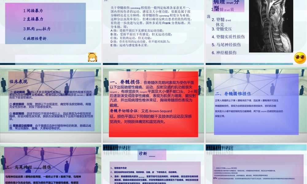 2022年医学专题—脊髓胸腰段损伤完整版.ppt