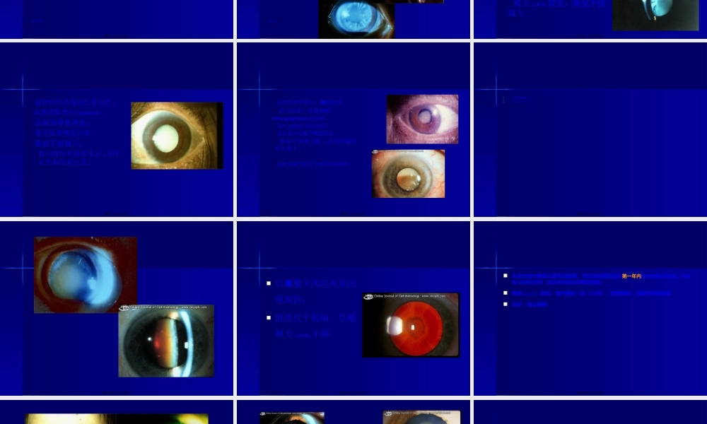2022年医学专题—哈医大一院眼科医院(1).ppt