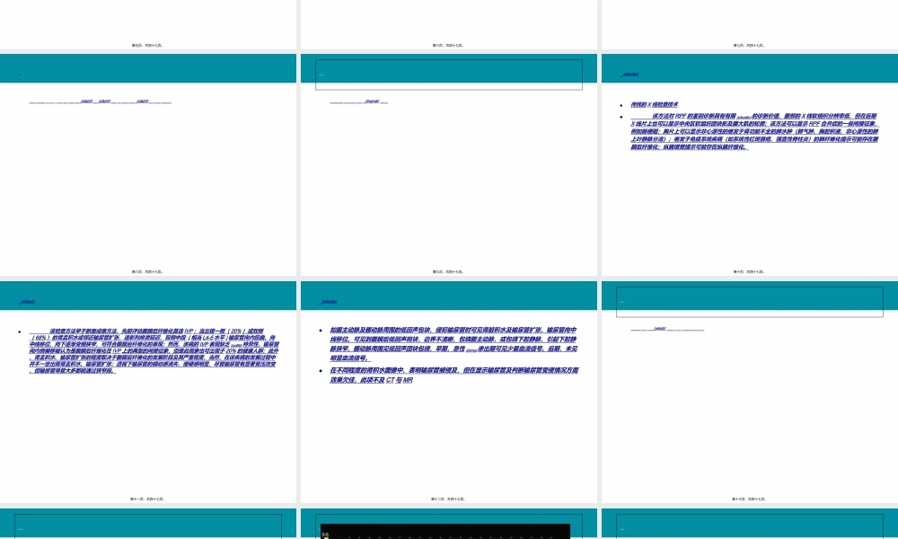 2022年医学专题—腹膜后纤维化-20131106.ppt