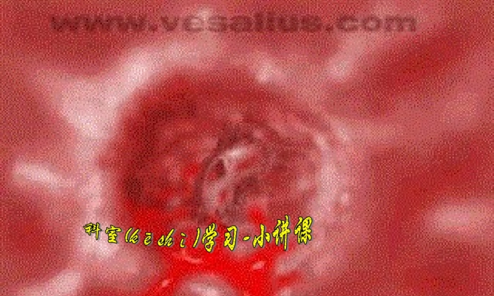 2022年医学专题—上消化道大量出血-09-李晓玲.ppt