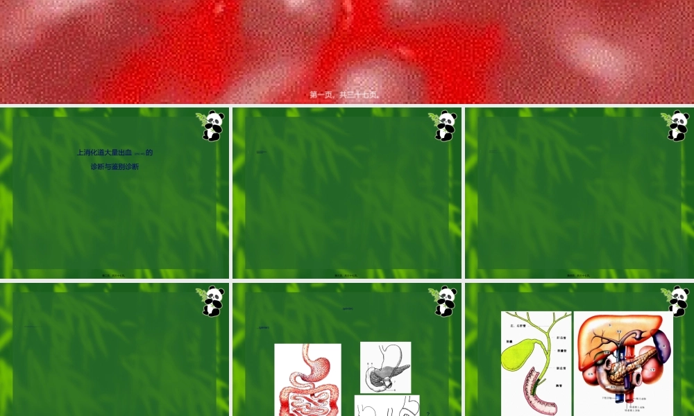 2022年医学专题—上消化道大量出血-09-李晓玲.ppt