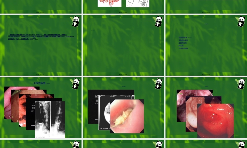 2022年医学专题—上消化道大量出血-09-李晓玲.ppt