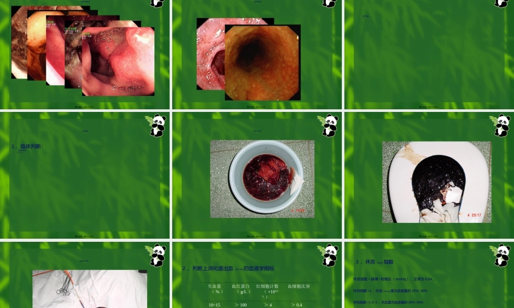 2022年医学专题—上消化道大量出血-09-李晓玲.ppt