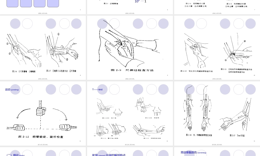 2022年医学专题—教学查房-儿童多发骨折归纳(1).ppt