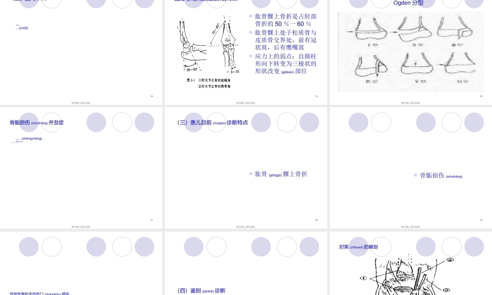 2022年医学专题—教学查房-儿童多发骨折归纳(1).ppt