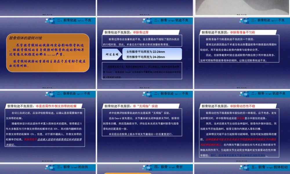 2022年医学专题—与全膝关节置换相关的髌股关节并发症.ppt