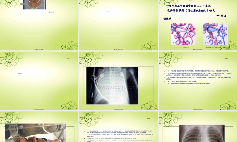 2022年医学专题—新--生--儿--肺--炎(1).ppt