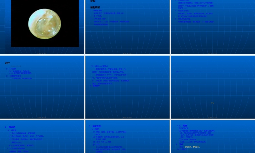 2022年医学专题—先天性耳前瘘管.ppt