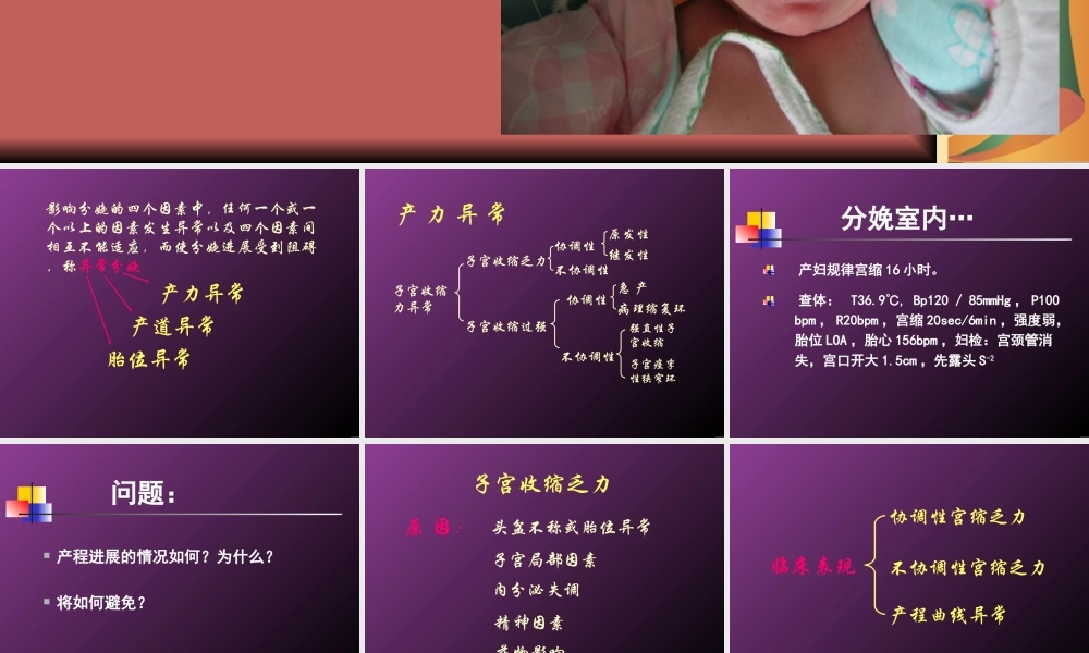 坐骨结节间径7cm内诊.ppt