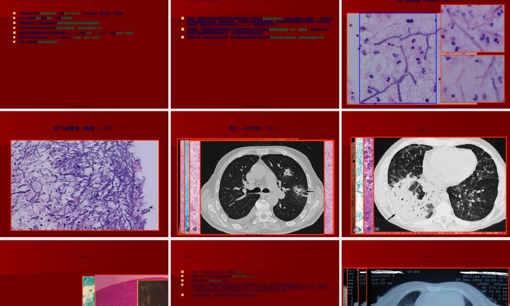 2022年医学专题—免疫功能缺陷患者的肺部感染.ppt