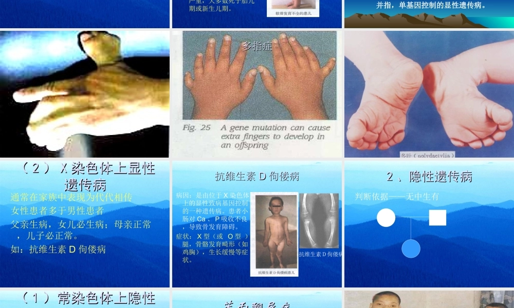 [整理后]一、人遗传病概述(1).ppt